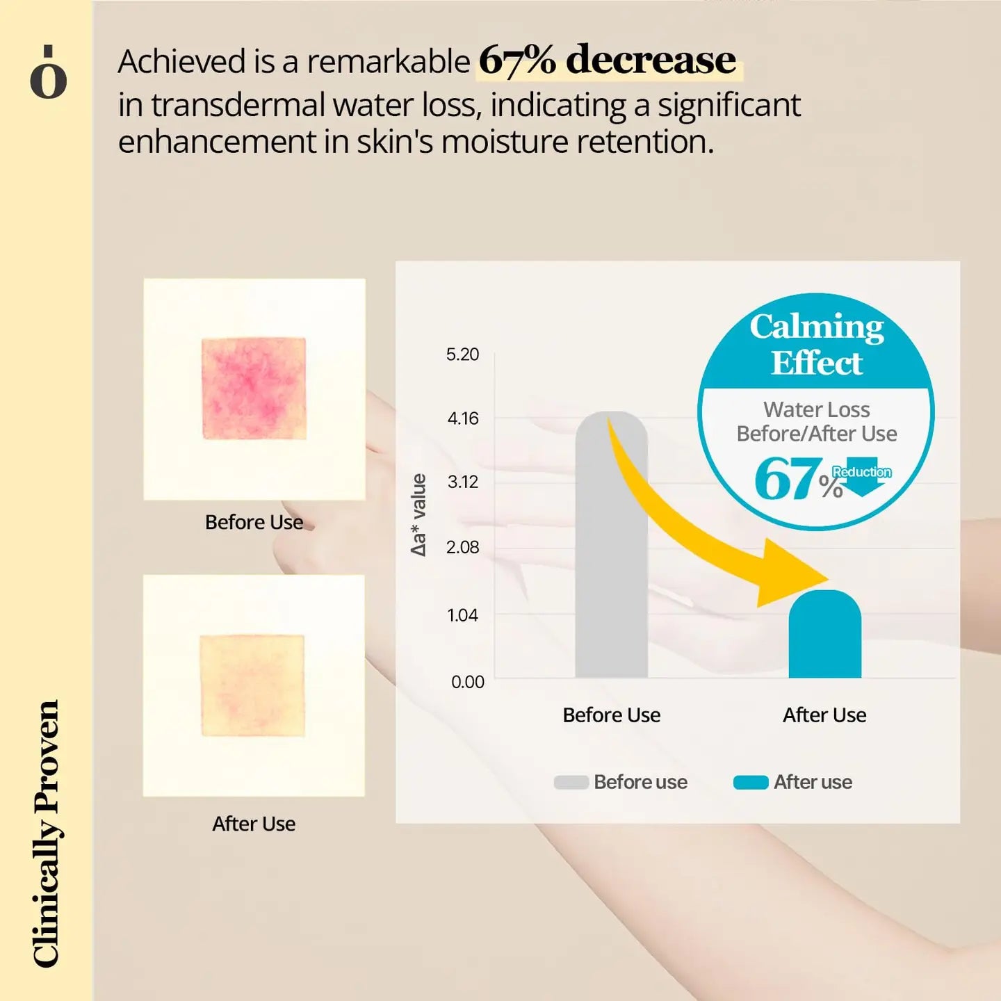 Ongredients Skin Barrier Calming Lotion (Imperfect Box)